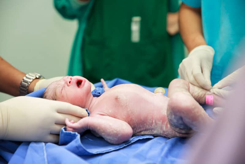 A newborn baby that was just delivered, might be showing signs of sepsis.