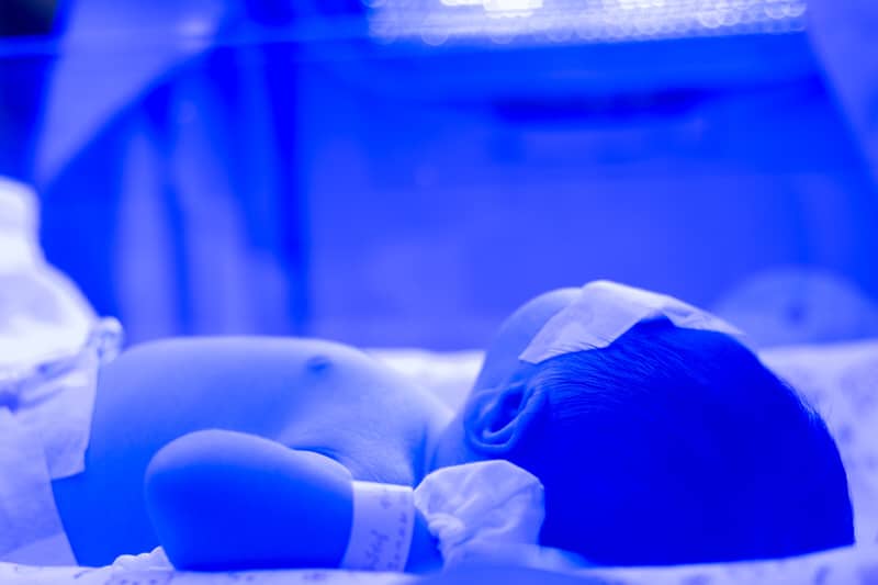 How Does Light Therapy Work For Jaundice In Newborns Is It Safe For