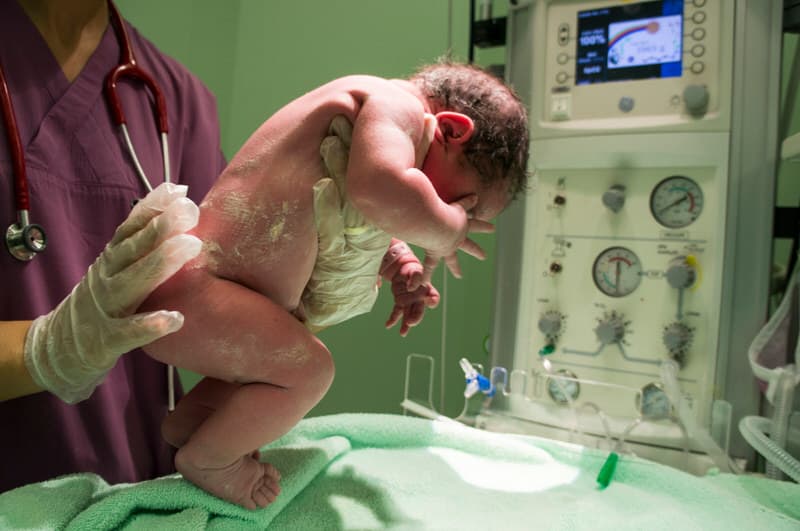 Why Do Doctors Spank Babies When They Are Born? Is It Really Necessary?