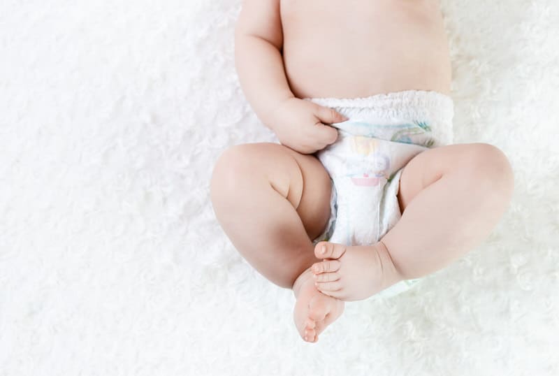 An infant boy has a diaper rash after drinking whole milk.