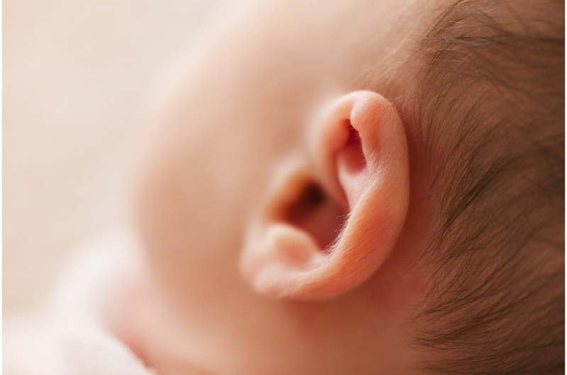Skin Tags On Ear At Birth - What Are They?