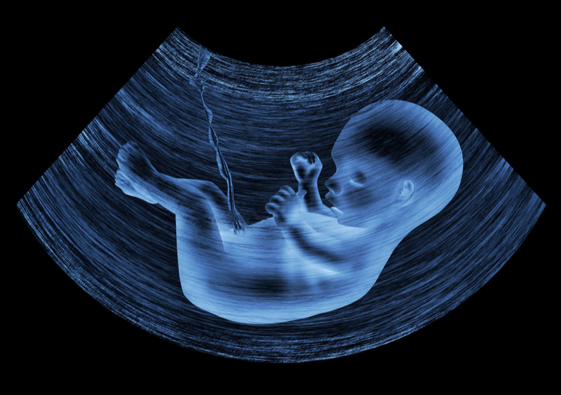 An ultrasound of a baby in mom's womb