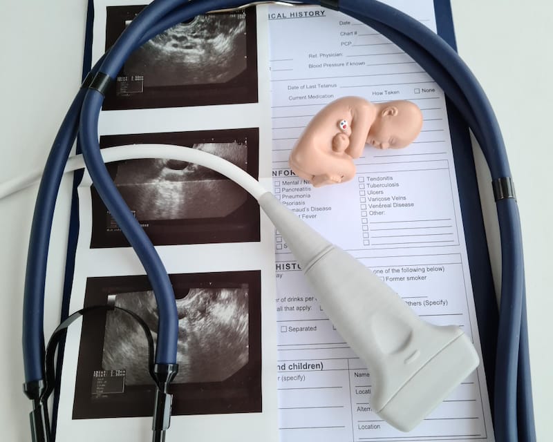 An OB-GYN is using a model of a fetus, along with patient ultrasound results, to discuss hypo-coiling of the umbilical cord with the pregnant patient.