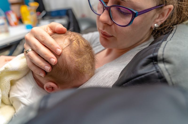 A mom is at her baby's pediatricians office to have his cradle cap looked at